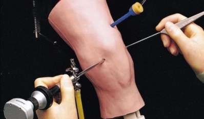 Un congrès à Marrakech met en avant les nouvelles techniques thérapeutiques en arthroscopie Un congrès à Marrakech met en avant les nouvelles techniques thérapeutiques en arthroscopie