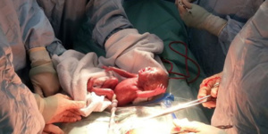 Tounfite : Une femme enceinte et son bébé sauvés de justesse grâce à une intervention très délicate sur le terrain Tounfite : Une femme enceinte et son bébé sauvés de justesse grâce à une intervention très délicate sur le terrain