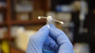 Implants vaginaux défectueux: des patientes sud-africaines portent plainte Implants vaginaux défectueux: des patientes sud-africaines portent plainte