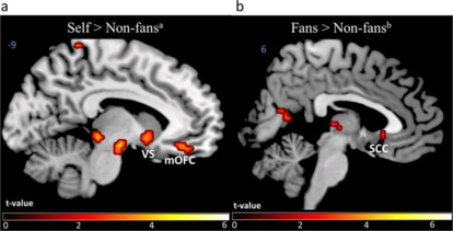 Etre fan de football rend-il altruiste ? Etre fan de football rend-il altruiste ?