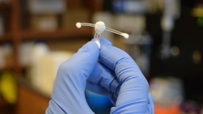 Etude : Invention d’un implant vaginal antisida