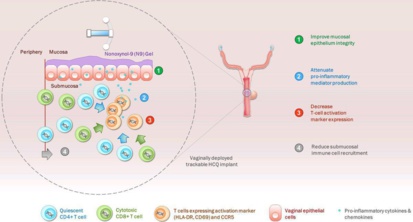 Etude : Invention d’un implant vaginal antisida