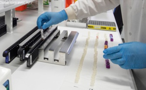 Les pays africains effectuent plus de 8,3 millions de tests du COVID-19, alors que le taux d'infection augmente, selon le CDC Afrique