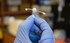 Etude : Invention d’un implant vaginal antisida