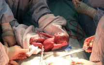 Tounfite : Une femme enceinte et son bébé sauvés de justesse grâce à une intervention très délicate sur le terrain Tounfite : Une femme enceinte et son bébé sauvés de justesse grâce à une intervention très délicate sur le terrain